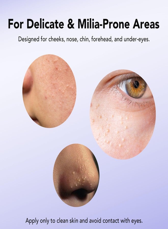 ديرمفري مزيل الدخينات 30 مل، علاج موضعي للدخينات مع حمض الساليسيليك، سيروم لتنقية البشرة من حب الشباب الدخيني - Image 5